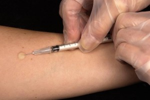 В Казахстане смертность от туберкулеза сократилась на 20%