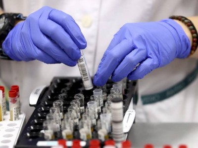 
                    В Казахстане за сутки зарегистрировали 50 новых случаев заболевания КВИ
                