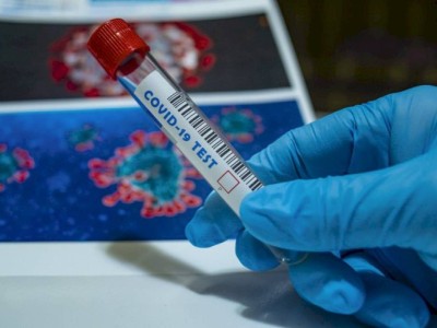 
                    Суточная заболеваемость COVID-19 в Казахстане составила 2089 человек
                
