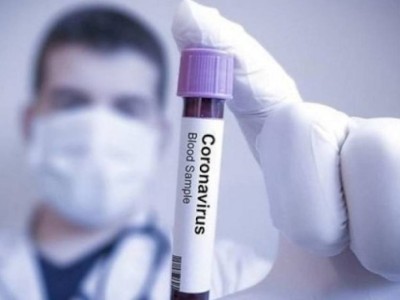 
                    С какими последствиями для здоровья сталкиваются переболевшие COVID-19
                