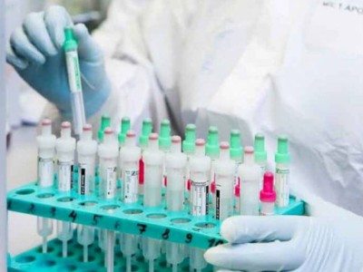 
                    За сутки в Казахстане выявили еще 1 469 случаев коронавируса
                