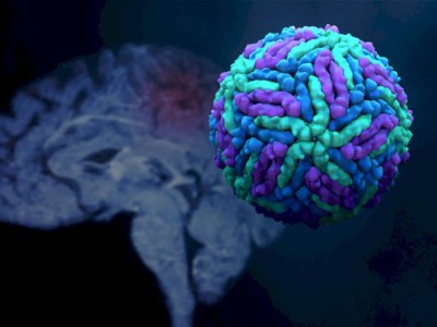 
                    Как COVID-19 воздействует на мозг человека – результаты исследований
                