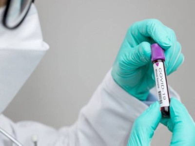
                    670 казахстанцев заболели COVID-19 за прошедшие сутки
                