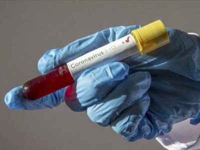 
                    819 случаев заболевания COVID-19 выявлено в Казахстане за прошедшие сутки
                