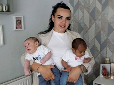 
                    Ирония генетики: женщина родила близнецов с разным цветом кожи
                