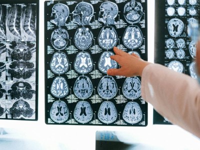 
                    Как в Казахстане выявляют онкозаболевания на ранних стадиях
                