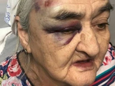 
                    Полиция Алматы задержала сбившего пенсионерку водителя
                