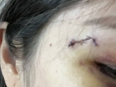 Агрессивная пациентка напала на врачей в Алматы