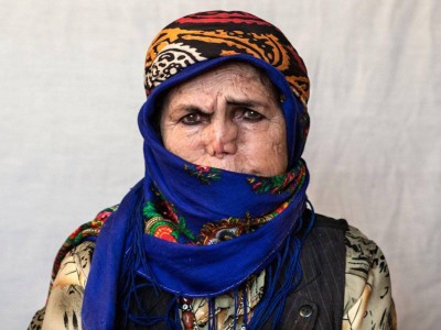 
                    246 больных лепрой проживают в Казахстане
                