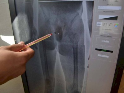 
                    В прямой кишке осужденный пытался пронести телефон и наркотик на территорию СИЗО
                