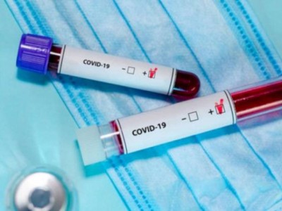 
                    Более тысячи заболевших COVID-19 выявлены в Казахстане
                