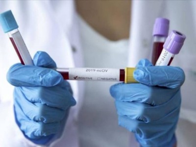 
                    Более 650 случаев заболевания COVID-19 выявлено в Казахстане за прошедшие сутки
                