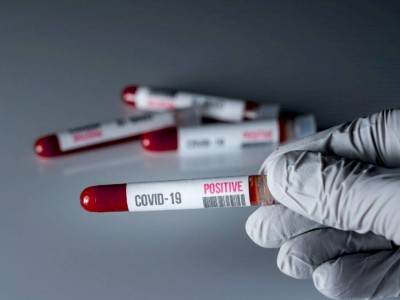 
                    729 новых случаев COVID-19 зарегистрировано в Казахстане
                