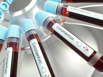 
                    В Казахстане увеличилось число заболевших коронавирусом
                