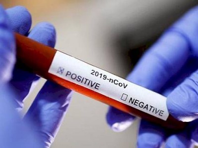 
                    В Казахстане за сутки выявлен 781 случай заболевания пневмонией с признаками COVID-19
                