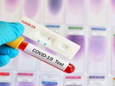 
                    В конце лета в Казахстане появится объединенная статистика по коронавирусу
                