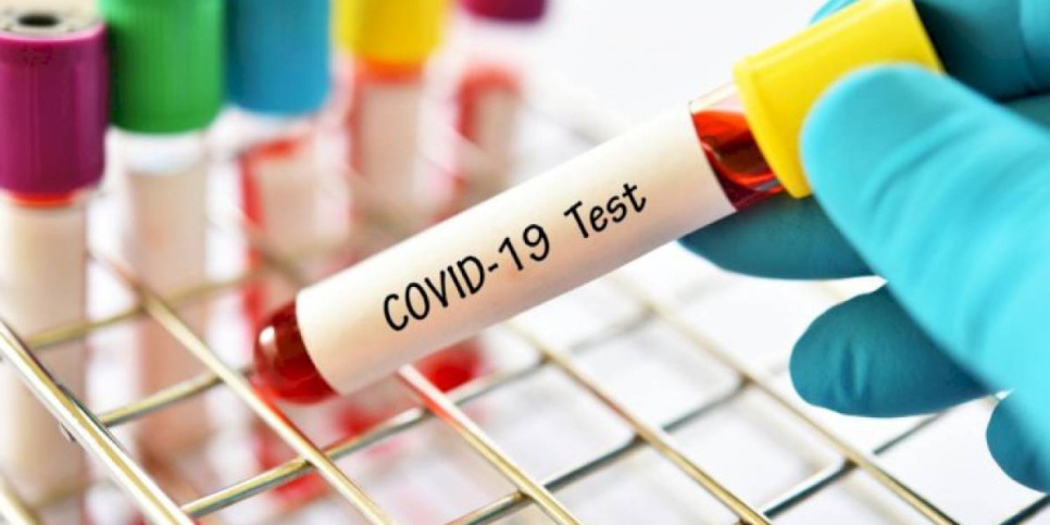 
                    За сутки в Казахстане выявили 78 случаев заболевания COVID-19
                