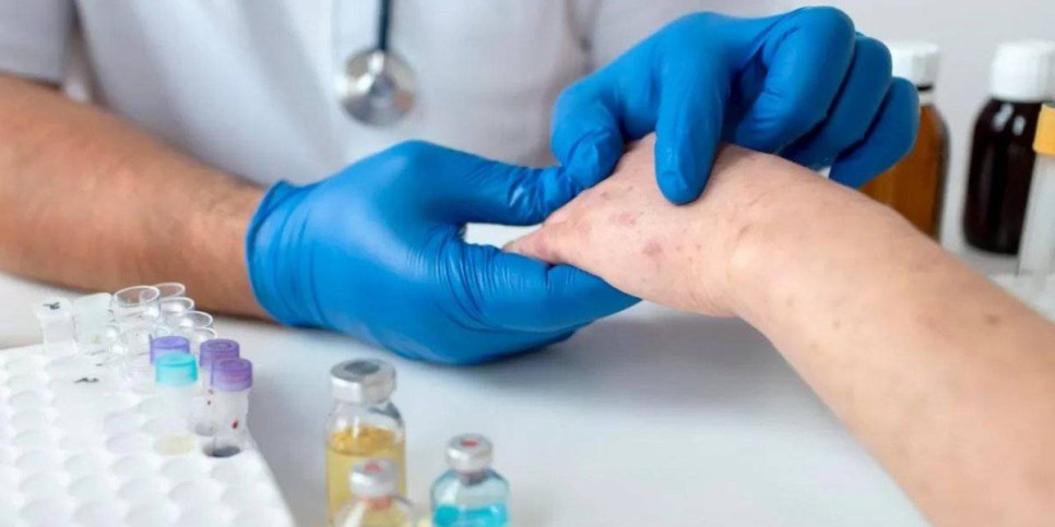 
                    Ситуация с корью в Астане остается напряженной
                