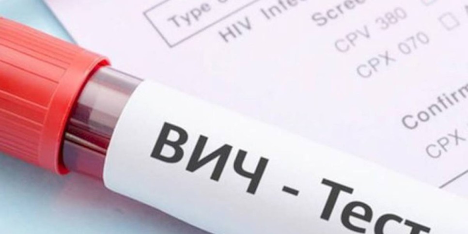 
                    В США создали генную терапию, уничтожающую ВИЧ
                