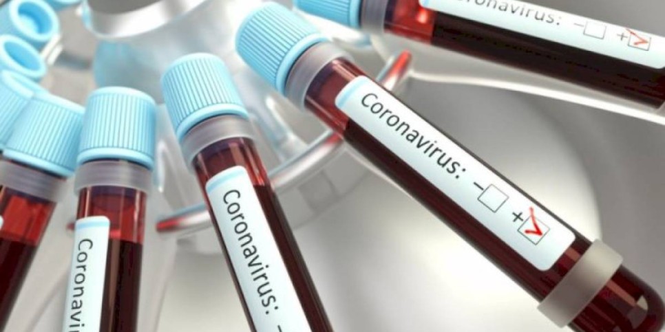 
                    За сутки в РК зарегистрировано 1148 заразившихся COVID-19
                