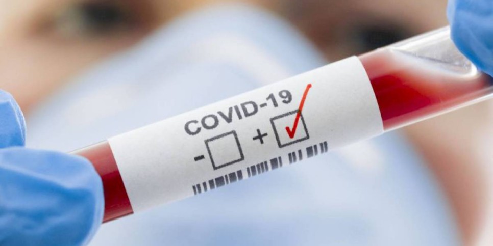 
                    В РК темпы суточной заболеваемости COVID-19 постепенно идут на спад
                