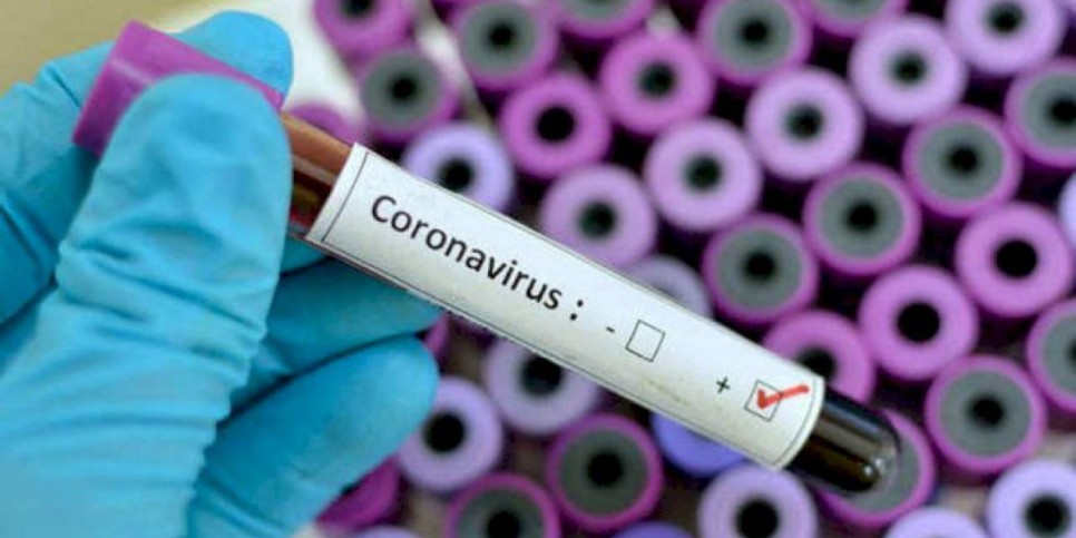 
                    В Казахстане за сутки зарегистрировано 2716 случаев COVID-19
                