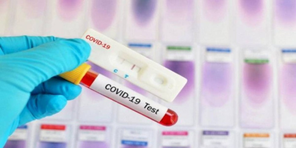 
                    За сутки в РК выявлено 1480 заразившихся COVID-19
                