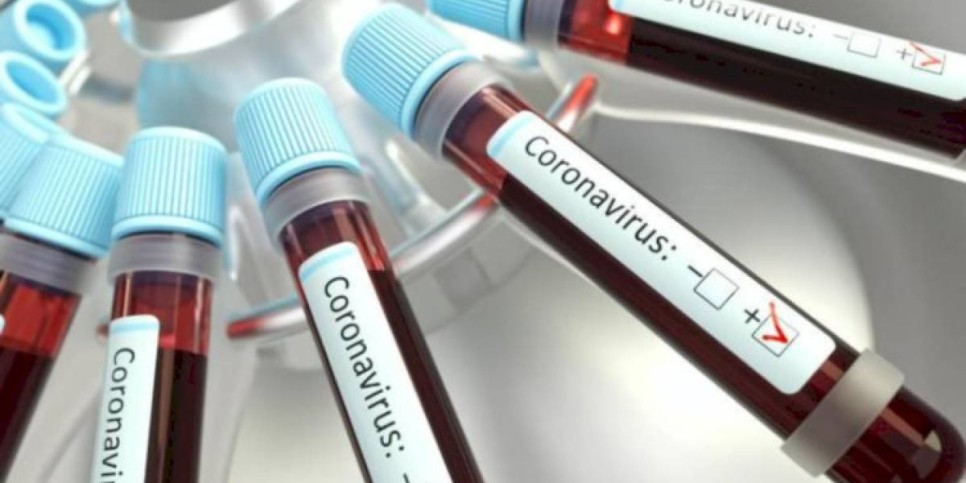 
                    В РК количество заразившихся COVID за сутки перевалило за тысячу
                