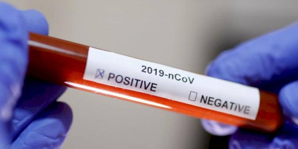 
                    За сутки в Казахстане выявили 769 заболевших Covid-19
                