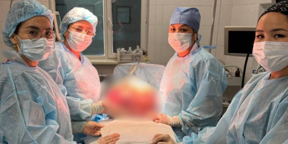 
                    Огромную миому удалили врачи 50-летней жещине в Таразе 
                