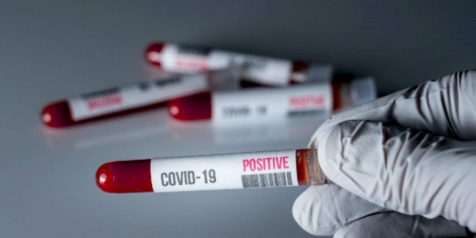 
                    729 новых случаев COVID-19 зарегистрировано в Казахстане
                